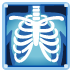 :x_ray: